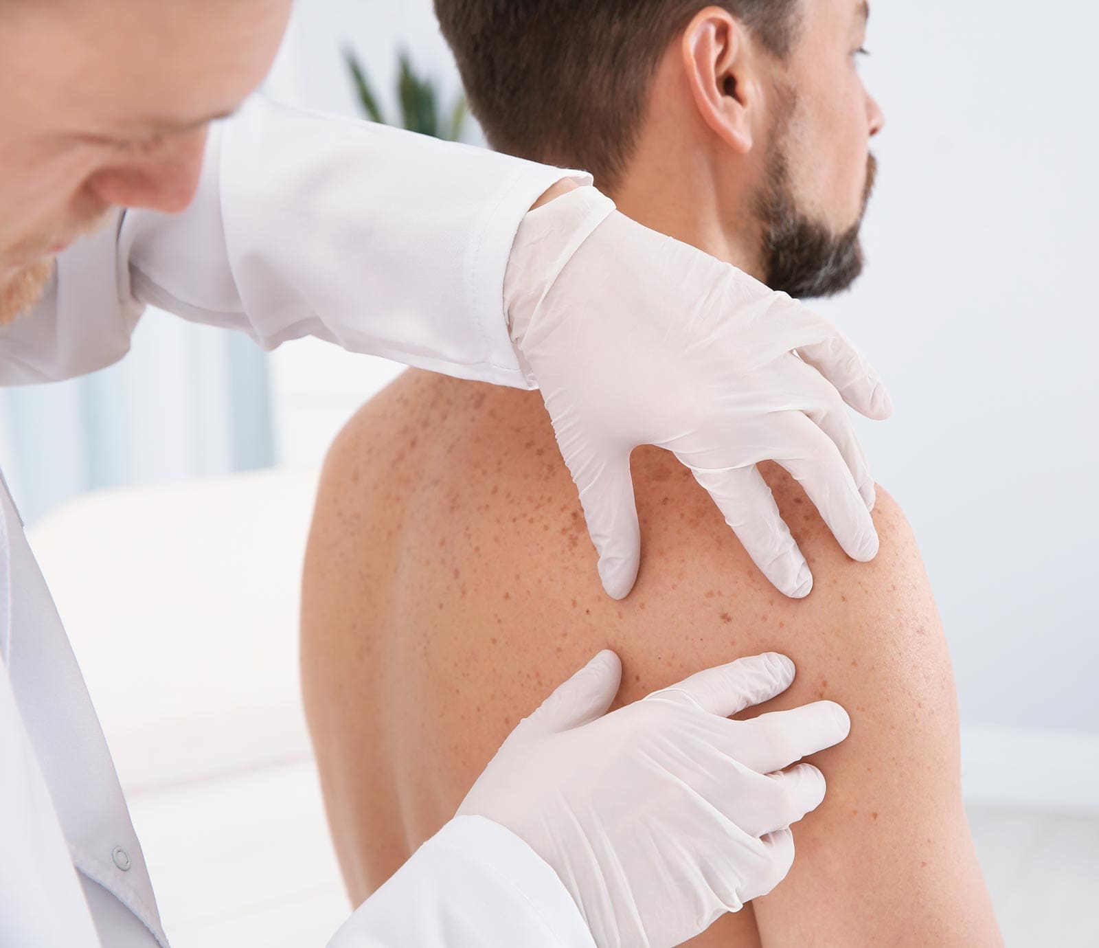 Skin exam at the dermatologist